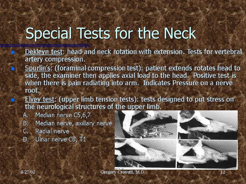 8/27/02 Gregory Crovetti, M.D. 12 Special Tests for the Neck Dekleyn test: head and